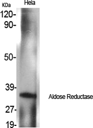 WB - Aldose Reductase Polyclonal Antibody AP68377